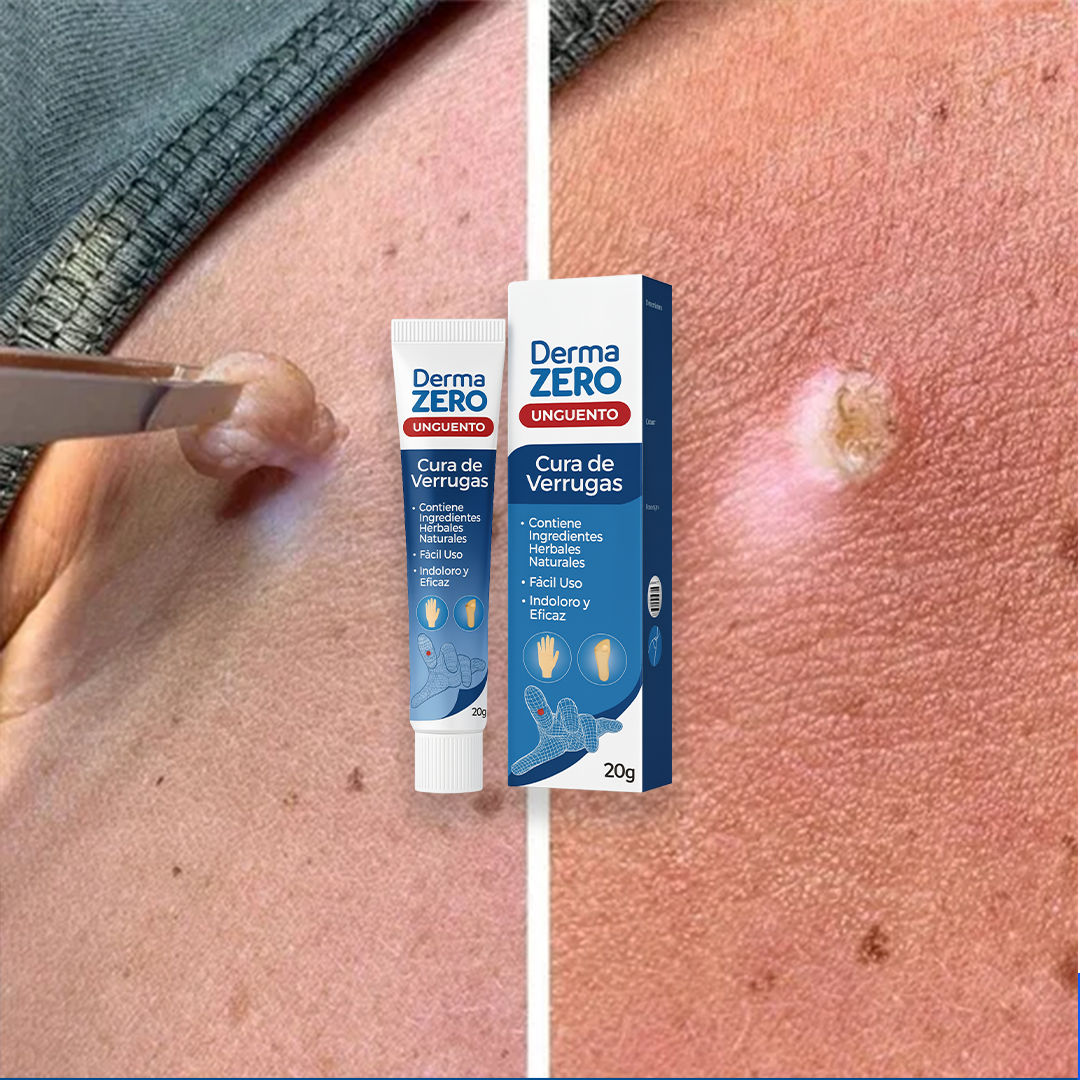 El Eliminador Definitivo de Verrugas - DermaZero
