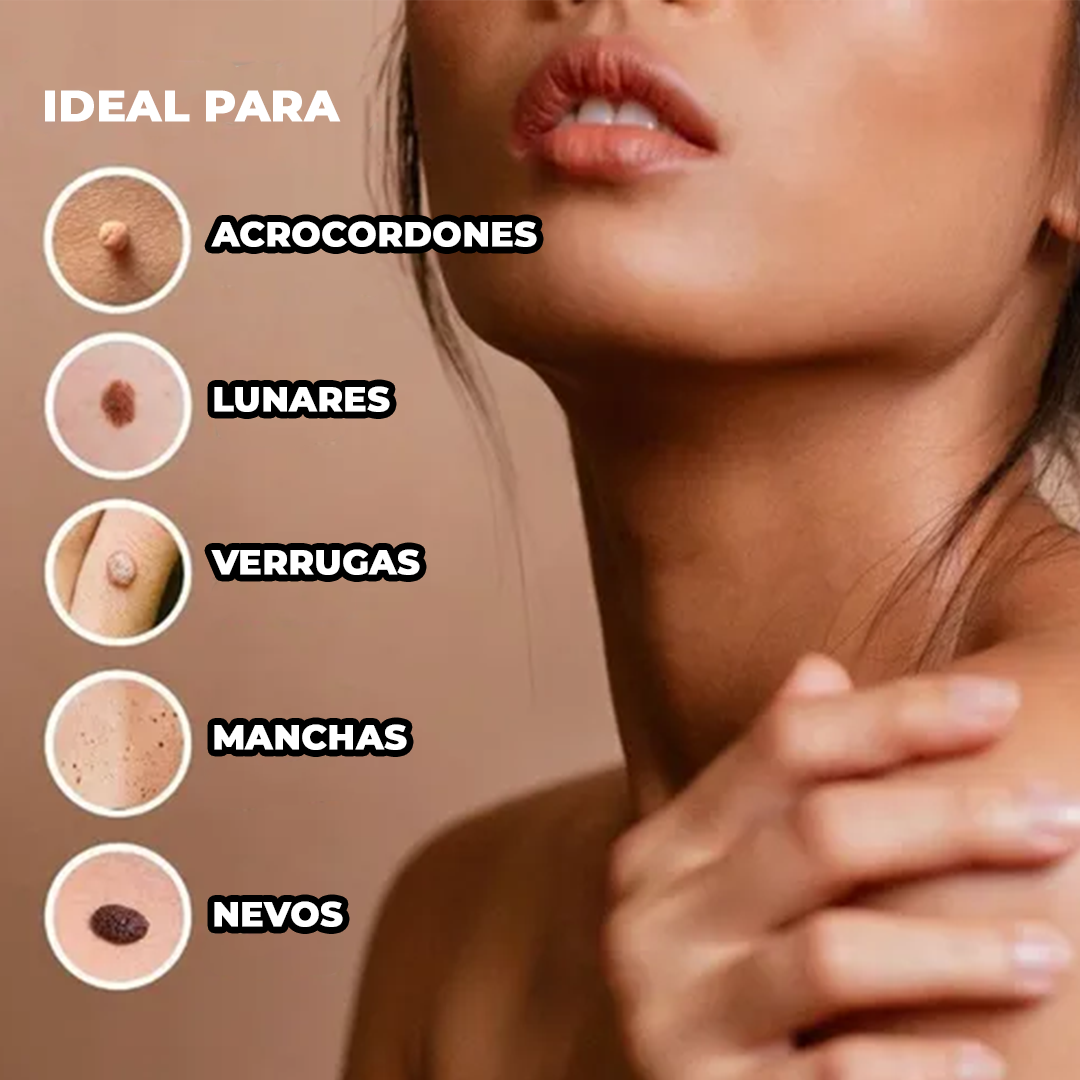 El Eliminador Definitivo de Verrugas - DermaZero