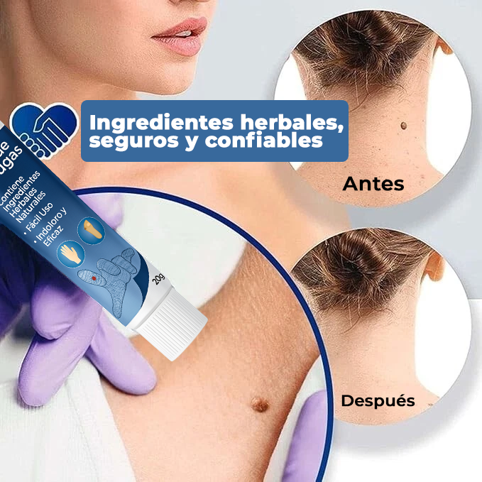 El Eliminador Definitivo de Verrugas - DermaZero