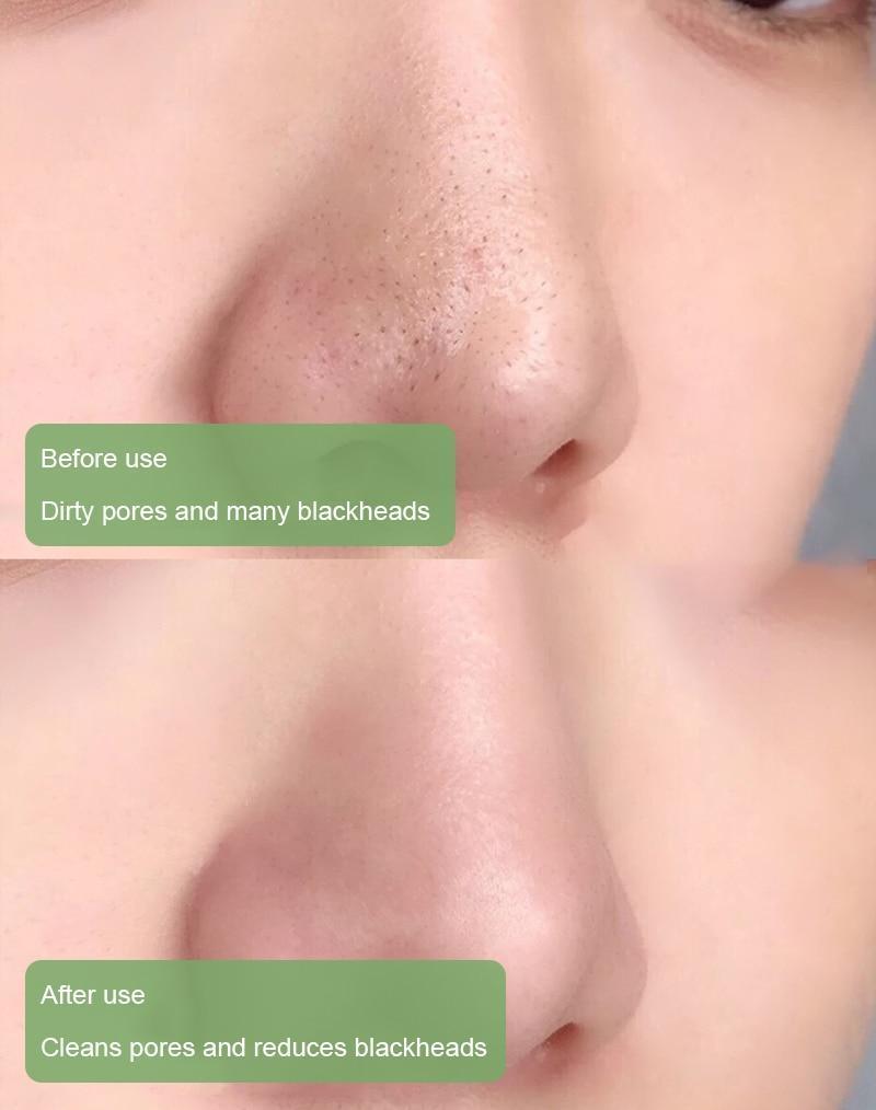 Mascarilla limpiadora desintoxicante de té verde