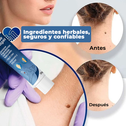 El Eliminador Definitivo de Verrugas - DermaZero