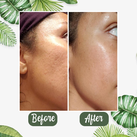 Mascarilla limpiadora desintoxicante de té verde