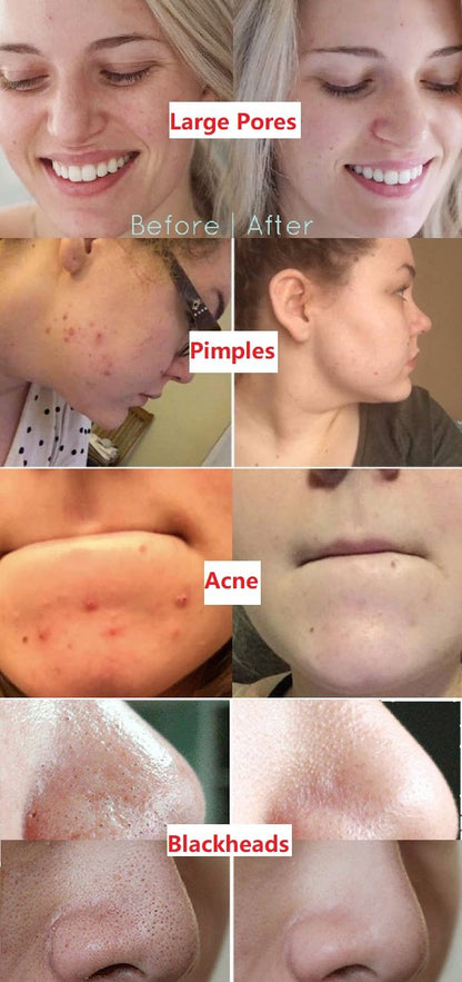 Mascarilla limpiadora desintoxicante de té verde